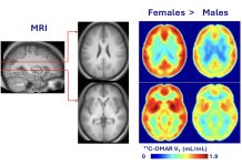 AN EVEN DEEPER UNDERSTANDING WITH DR. ELISE M. WEERTS: Where Are the Women in Cannabis Science?